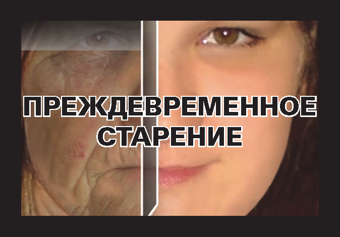 Russia 2013 Health Effects wrinkles - premature aging of skin
